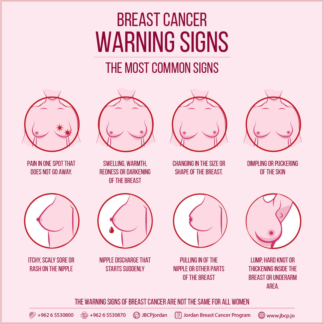 Breast Cancer Warning Signs  Jordan Breast Cancer Program